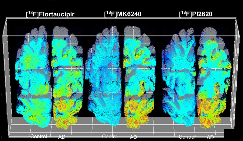Autoradiography comparison of [¹⁸F]Flortaucipir, [¹⁸F]MK6240, and [¹⁸F]PI2620 in Control versus AD whole-brain hemisphere sections.